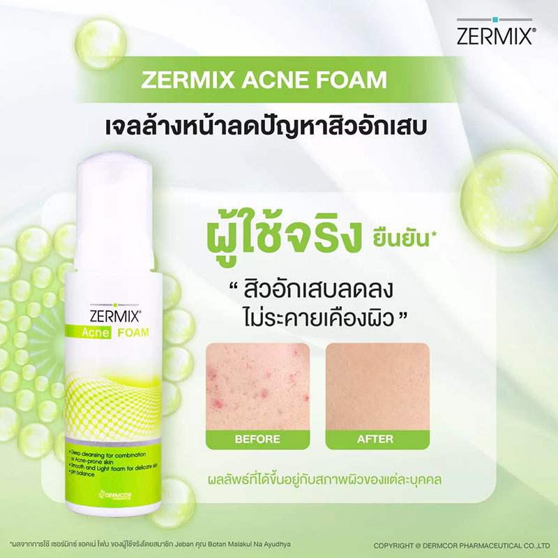 วิปโฟมล้างหน้า Zermix Acne Foam