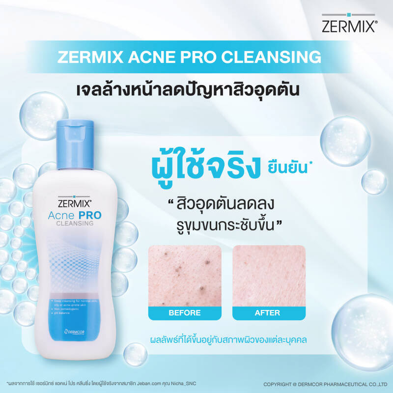 เจลล้างหน้า Zermix Acne Pro Cleansing