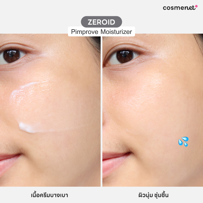 มอยส์เจอร์ไรเซอร์ Zeroid Pimprove Moisturizer