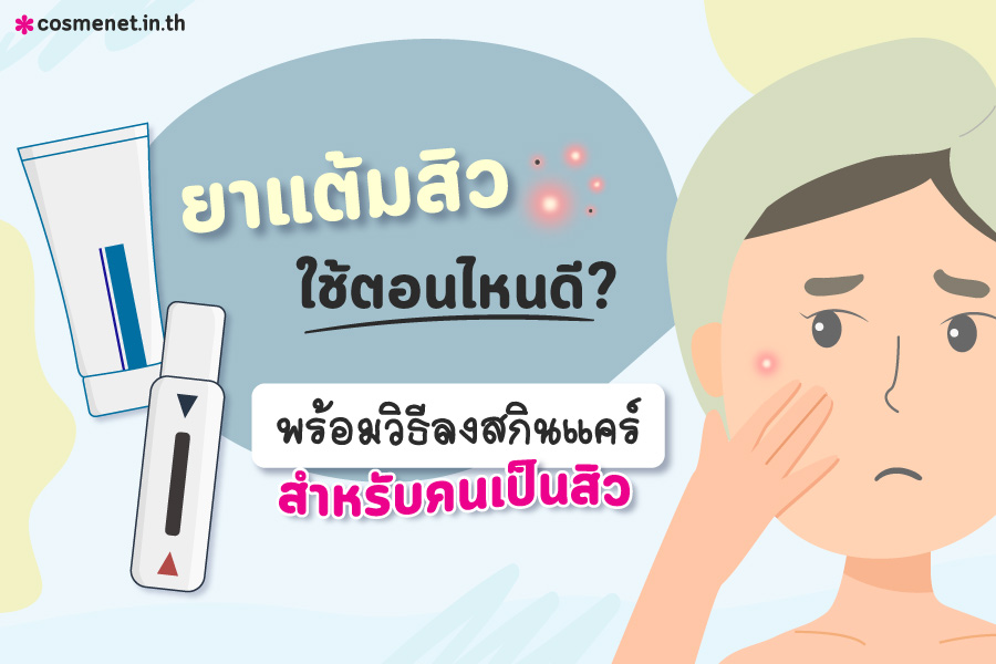 ยาแต้มสิวใช้ตอนไหนดี?