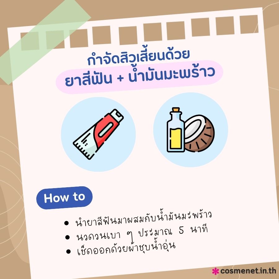 กำจัดสิวเสี้ยนด้วยยาสีฟัน น้ำมันมะพร้าว