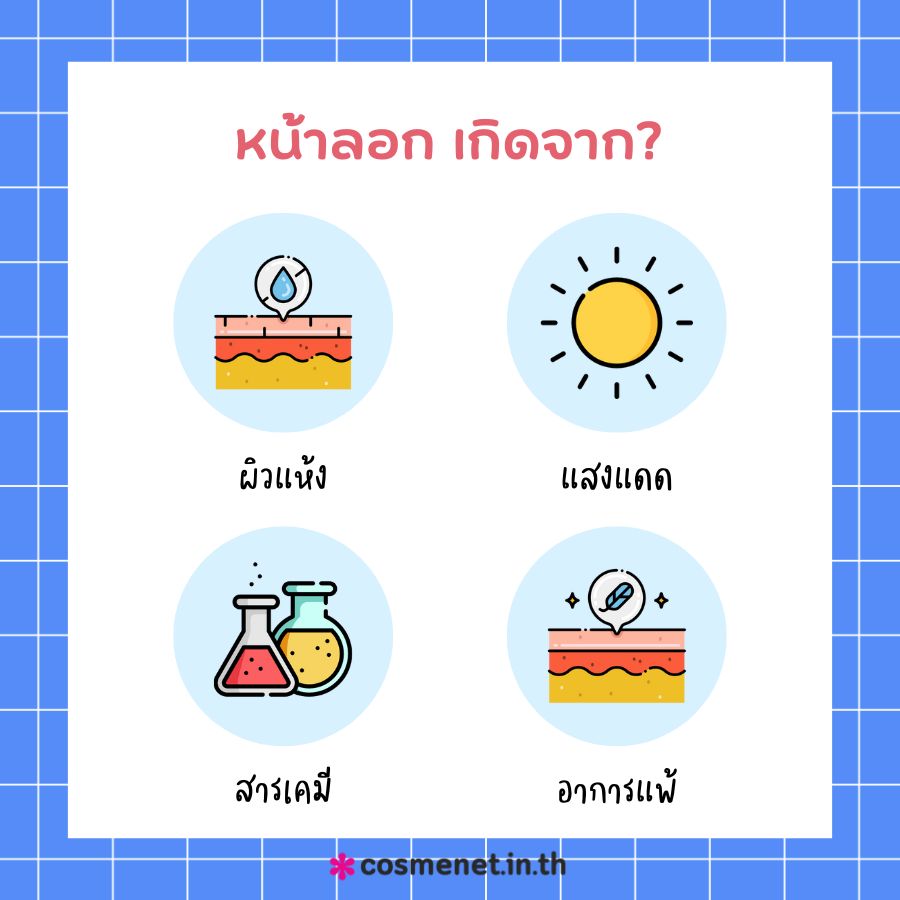 หน้าลอก เกิดจาก?