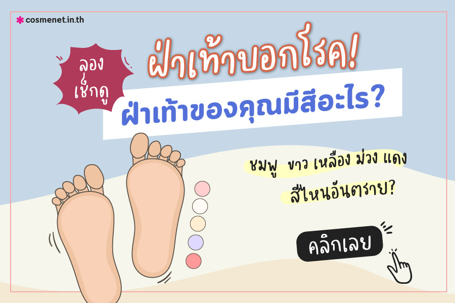 ฝ่าเท้าบอกโรค ฝ่าเท้าขาว ฝ่าเท้าเหลือง ฝ่าเท้าม่วง ฝ่าเท้าแดง