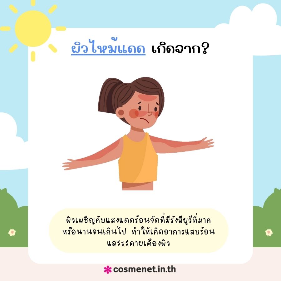 ผิวไหม้แดด เกิดจากอะไร?