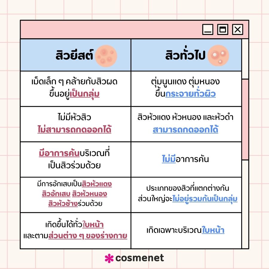 ลักษณะอาการของสิวยีสต์แตกต่างจากสิวทั่วไปอย่างไร