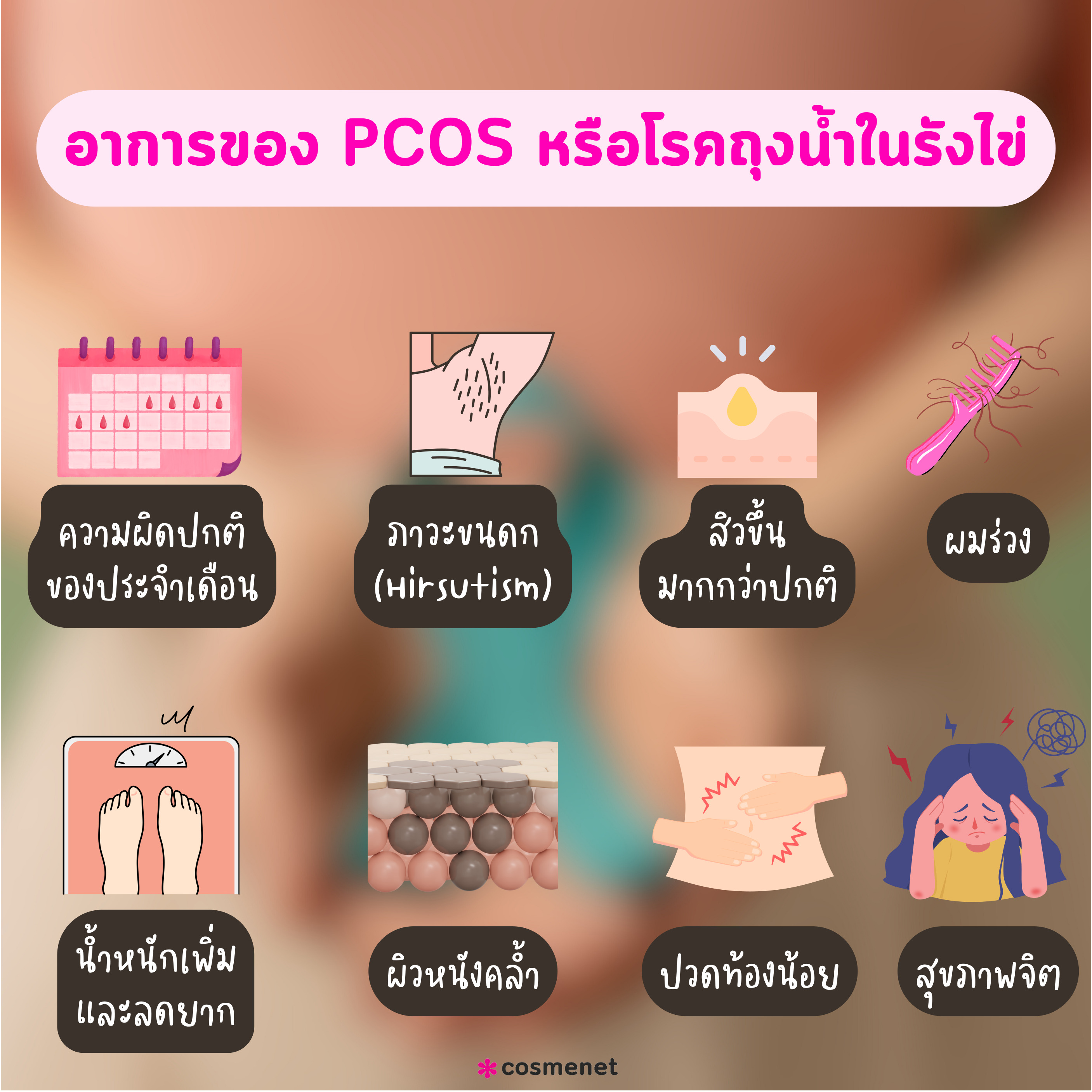 อาการของ PCOS ภาวะถุงน้ำในรังไข่