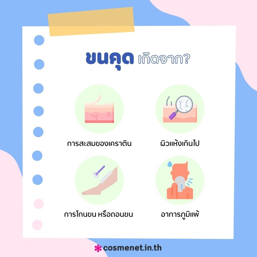 ขนคุดเกิดจาก