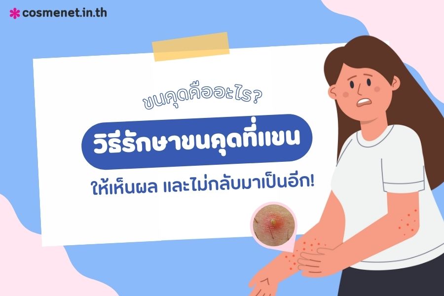 ขนคุดที่แขน