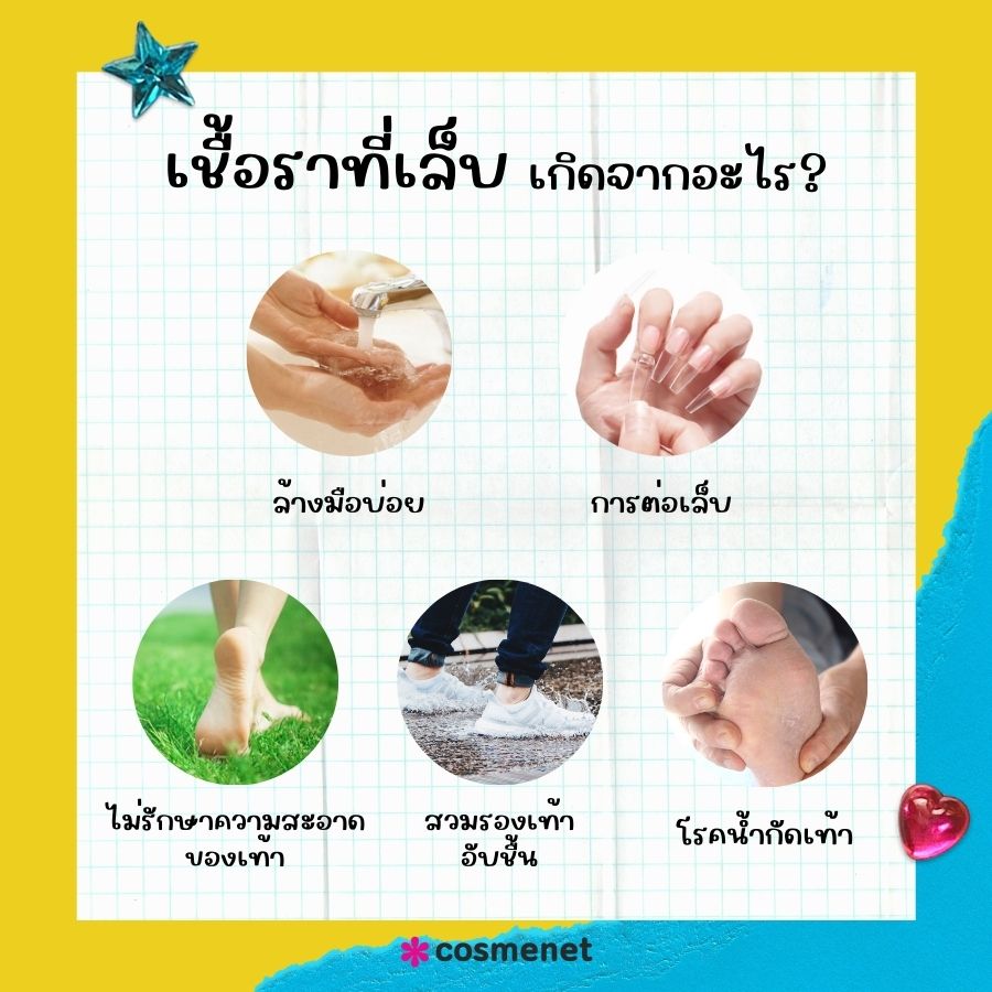 เชื้อราที่เล็บ เกิดจากอะไร?