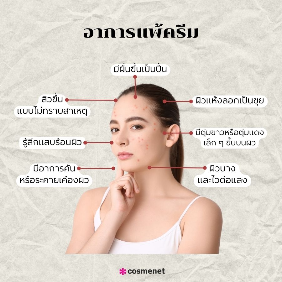 อาการแพ้ครีม