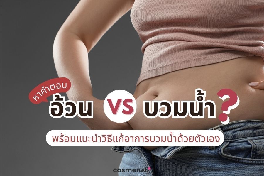 อ้วน หรือบวมน้ำ