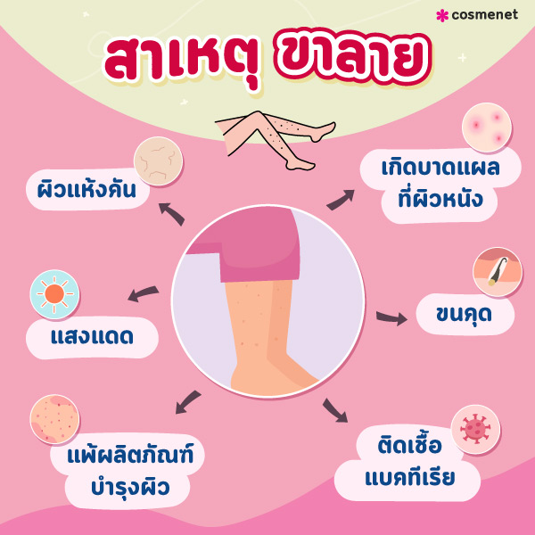 สาเหตุขาลาย