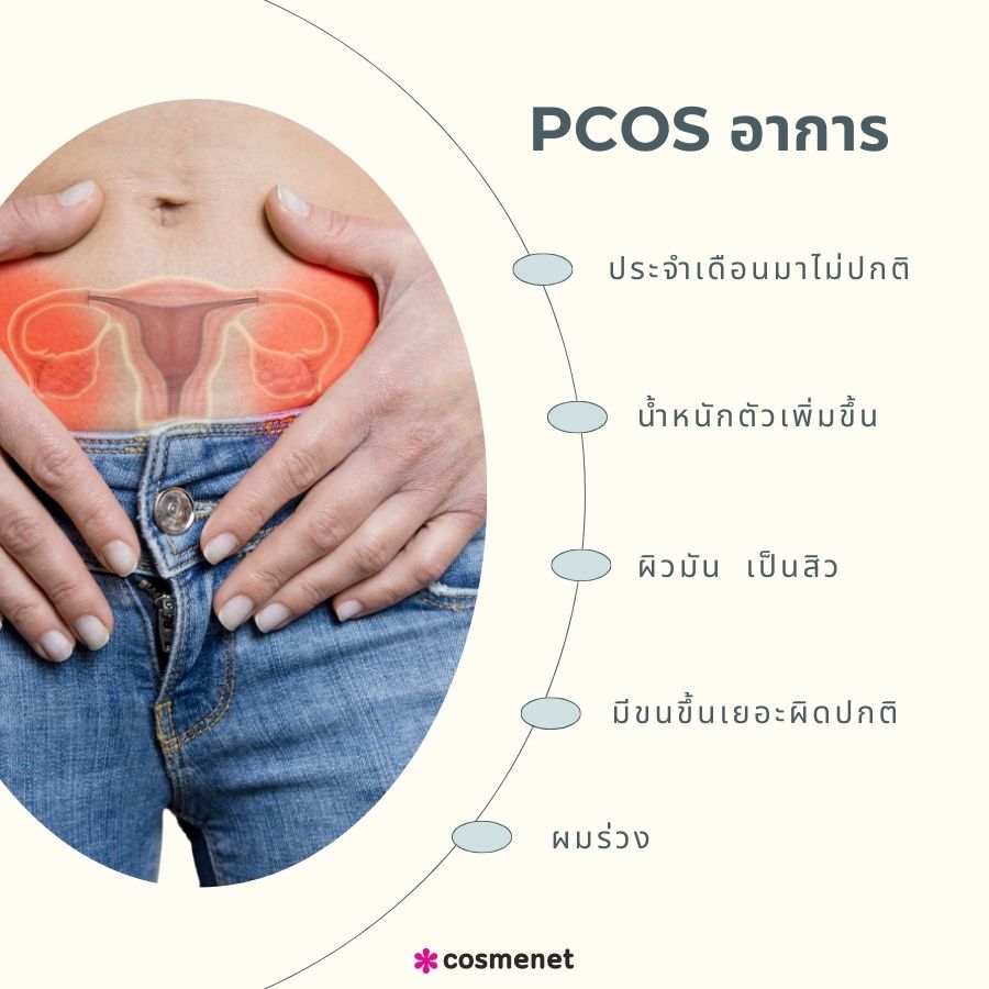 PCOS อาการ