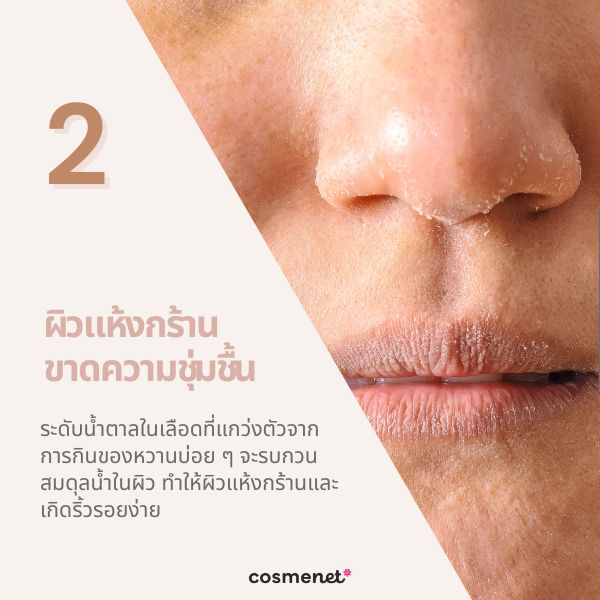 ผิวแห้งกร้าน ขาดความชุ่มชื้น