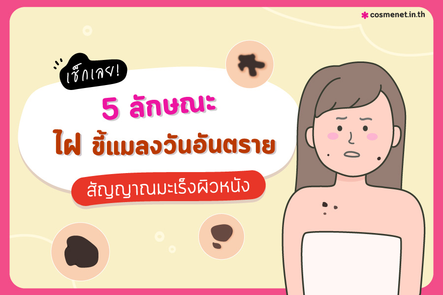 5 ลักษณะไฝ ขี้แมลงวันอันตราย สัญญาณมะเร็งผิวหนัง