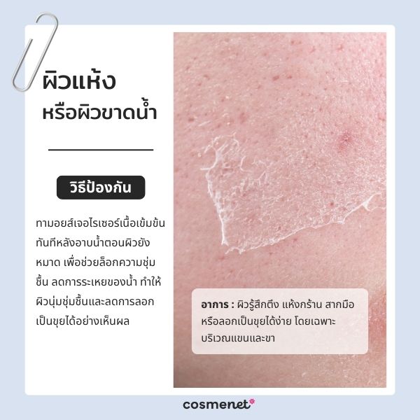 ปัญหาผิวแห้ง ผิวขาดน้ำ