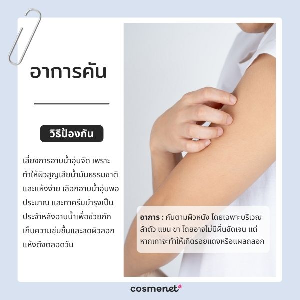 ปัญหาผิวแห้งคัน