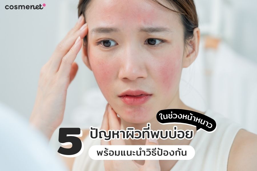 ปัญหาผิว หน้าหนาว