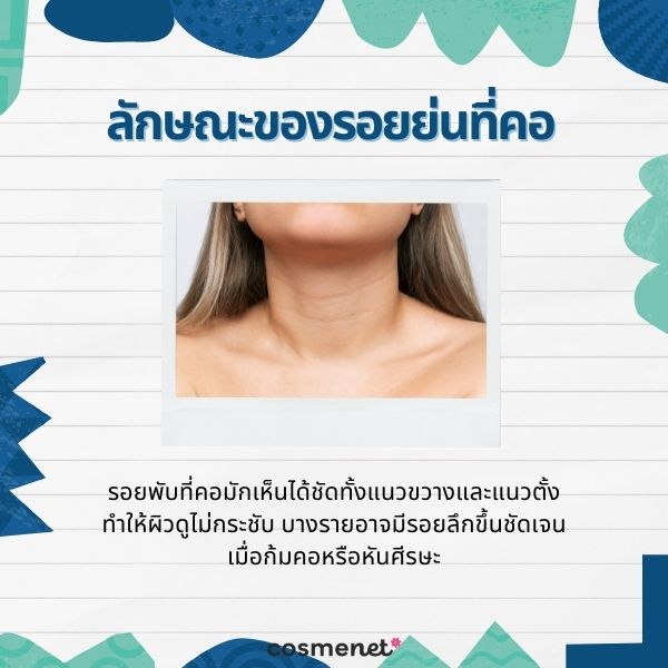ลักษณะของรอยย่นที่คอ