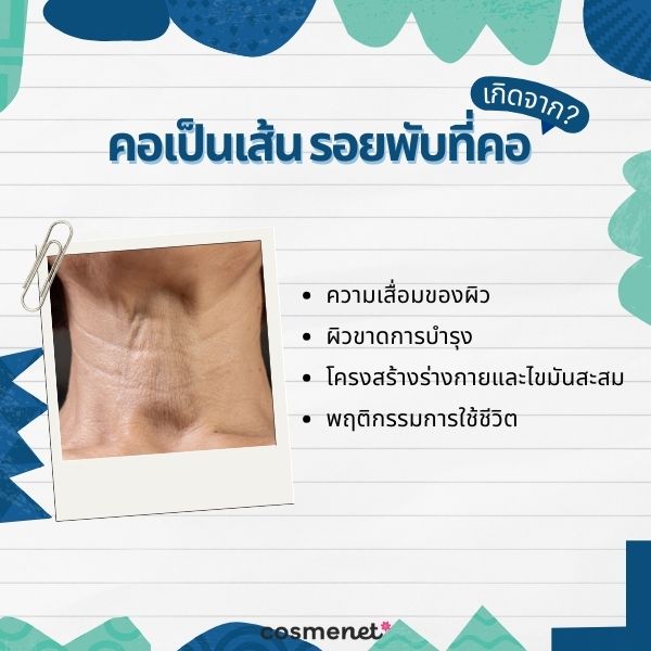 รอยพับที่คอ แก้ยังไง? 5 วิธีป้องกันรอยย่นที่คอ เปลี่ยนคอเป็นเส้นให้กลับมาเรียบเนียน คอเป็นเส้น รอยพับที่คอ เกิดจาก?