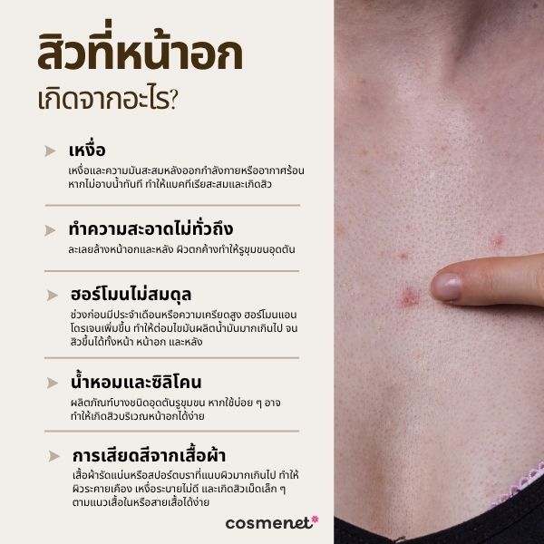 สิวที่หน้าอก เกิดจากอะไร?