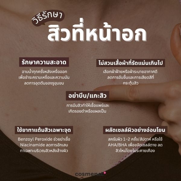 วิธีรักษาสิวที่หน้าอก