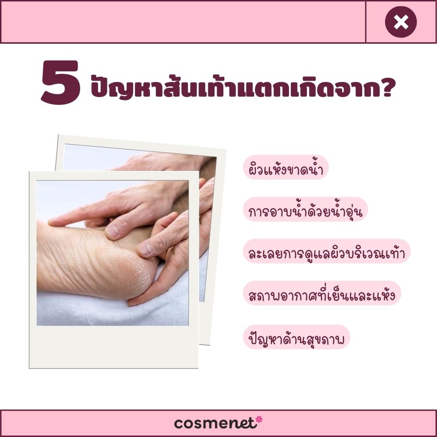 ปัญหาส้นเท้าแตก เกิดจาก