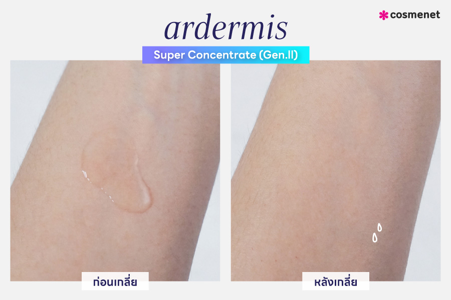 เซรั่ม ardermis Super Concentrate (Gen.ll)