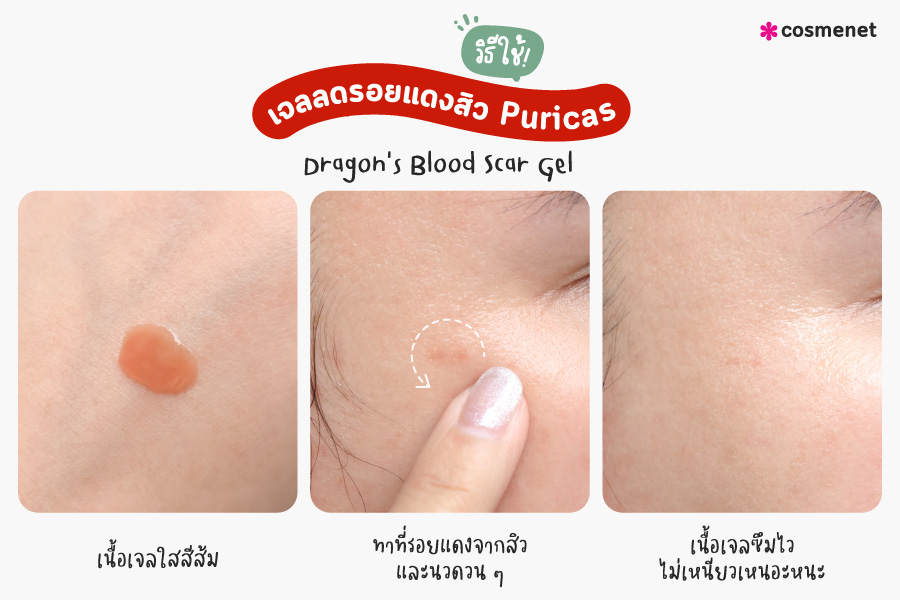 เจลลดรอยแดงสิว เจลลดรอยสิว Puricas Dragon's Blood Scar Gel (เพียวริก้าส์ แอคเน่ สการ์เจล)