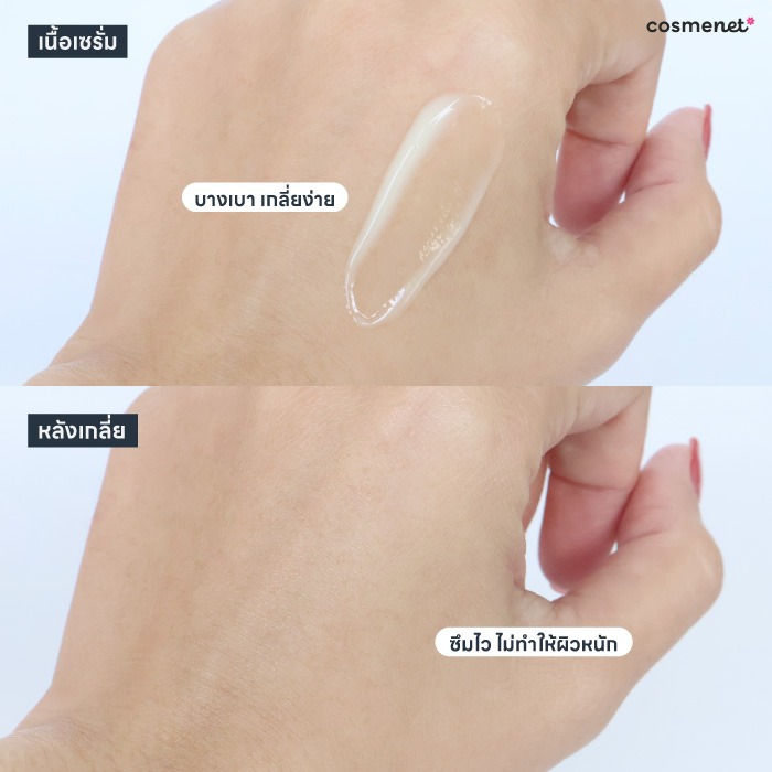 รีวืวเซรั่ม Eucerin Pro Acne Solution SOS Serum