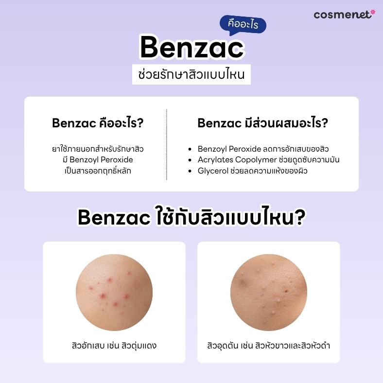 Benzac คืออะไร ช่วยรักษาสิวแบบไหน