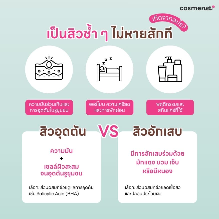 สิวขึ้นที่เดิมซ้ำ ๆ เกิดจากอะไร สิวขึ้นที่เดิมซ้ำ ๆ เกิดจากอะไร