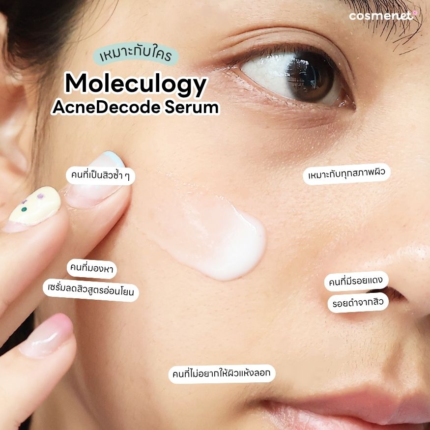 Moleculogy AcneDecode Serum เซรั่มลดสิวเหมาะกับใคร