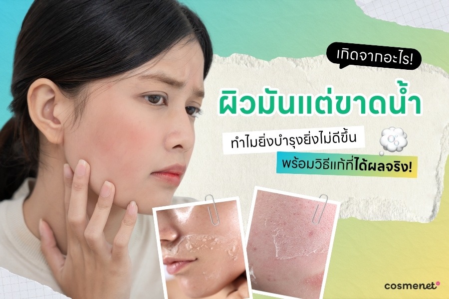 ผิวมันแต่ขาดน้ำ เกิดจากอะไร? ทำไมยิ่งบำรุงยิ่งไม่ดีขึ้น พร้อมวิธีแก้ที่ได้ผลจริง!