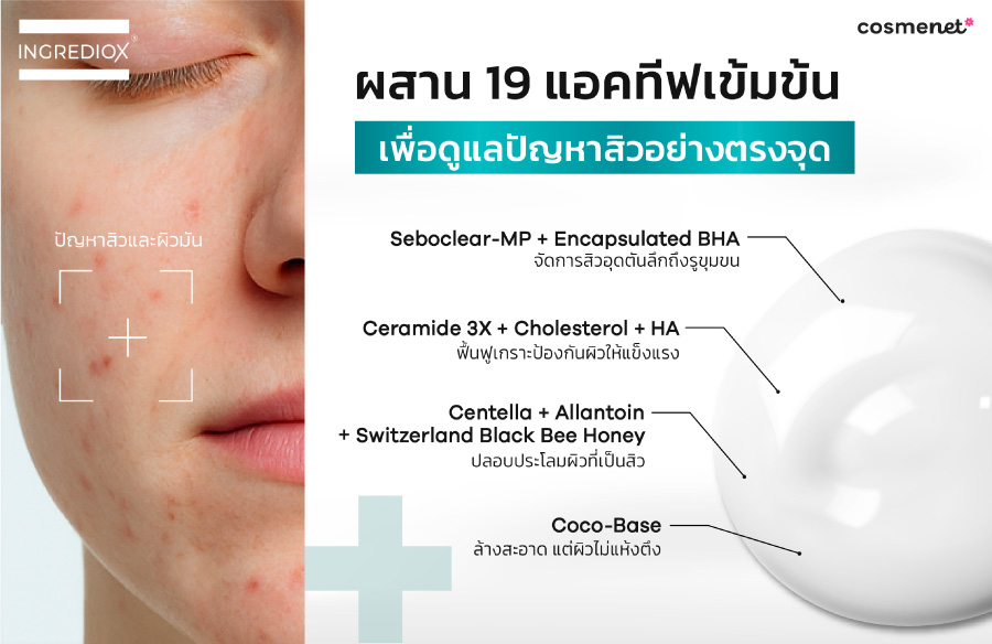 อยากลดสิวอุดตันต้องยอม "หน้าเห่อ" จริงไหม? เจาะลึกกลไกจัดการสิวอุดตัน แบบไม่ดันสิว ด้วยเจลล้างหน้า AVALANGE จาก INGREDIOX