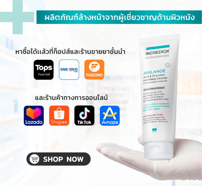 อยากลดสิวอุดตันต้องยอม "หน้าเห่อ" จริงไหม? เจาะลึกกลไกจัดการสิวอุดตัน แบบไม่ดันสิว ด้วยเจลล้างหน้า AVALANGE จาก INGREDIOX