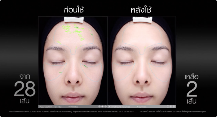  Age Miracle Intensive Wrinkle Correcting Cream ครีมลดเลือนริ้วรอย