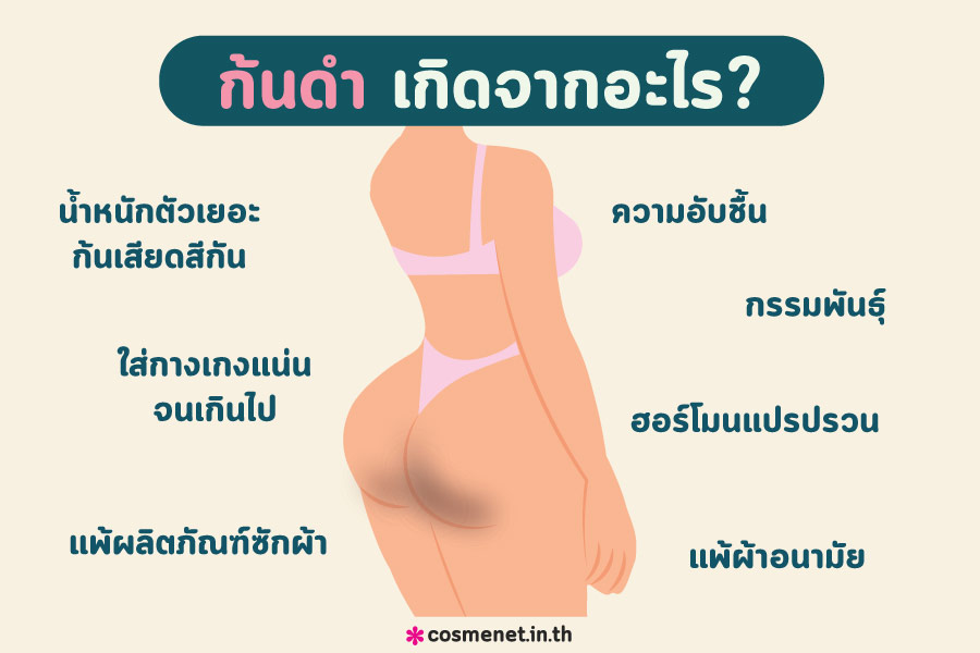 วิธีแก้ก้นดำเกิดจากอะไร