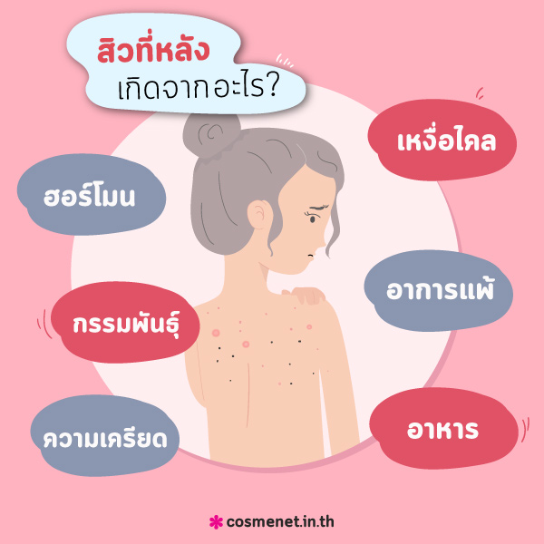 สิวที่หลัง เกิดจากอะไร