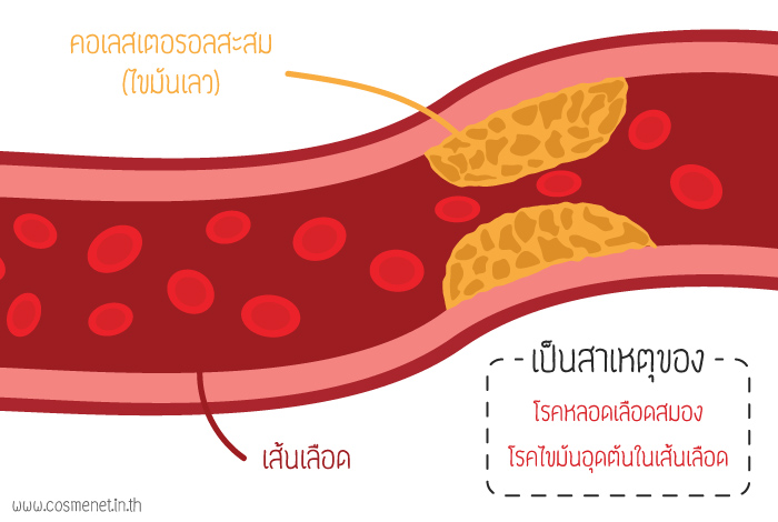 ลดคอเลสเตอรอล