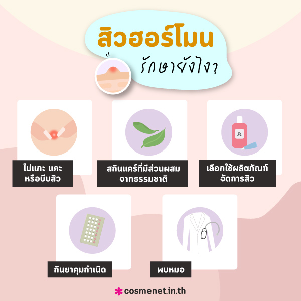 สิวฮอร์โมน รักษายังไง