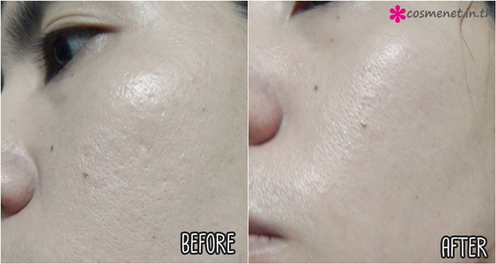 cosme* review Dr.Ci Labo VC100