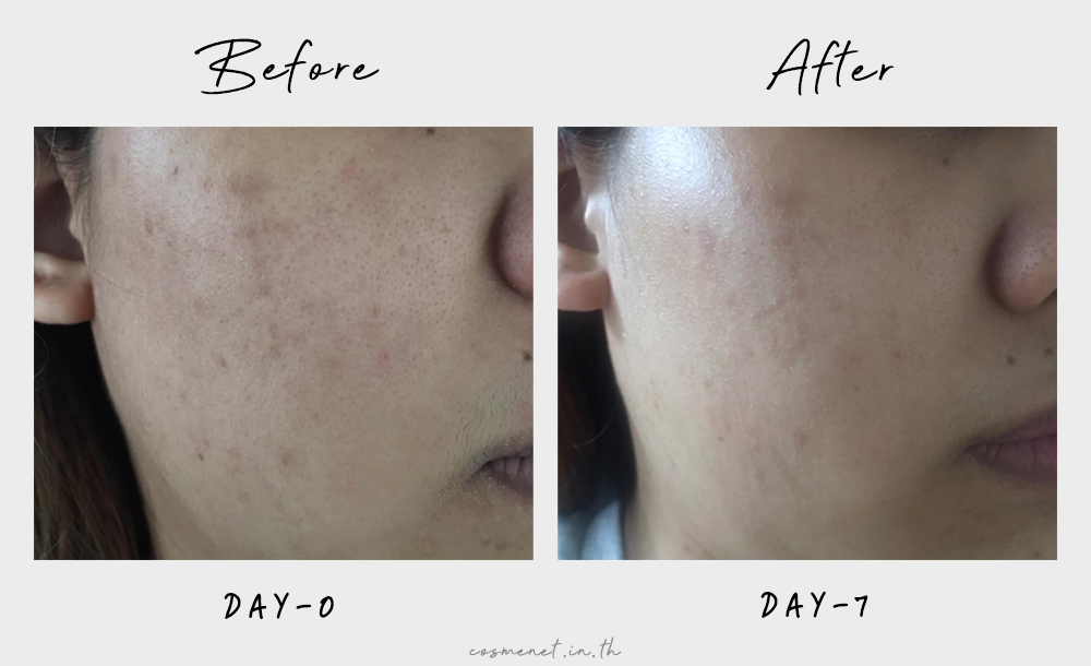 รีวิว หลังใช้เซรั่ม kiehl's dark spot