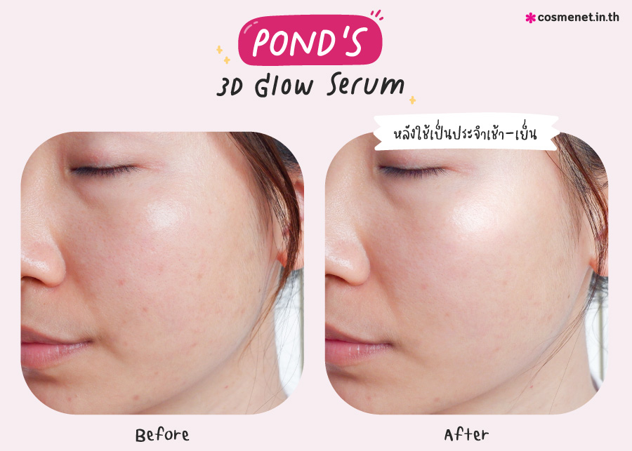 รีวิว ผลลัพธ์ เซรั่ม Pond's 3D Glow Serum