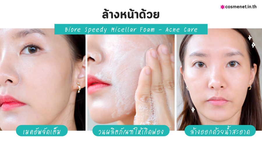 รีวิว โฟมล้างเครื่องสำอาง Biore Speedy Micellar Cleansing Foam - Acne Care