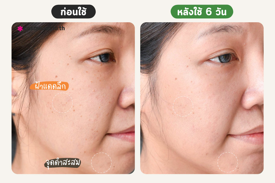 รีวิว การ์นิเย่แอมพูลเซรั่ม