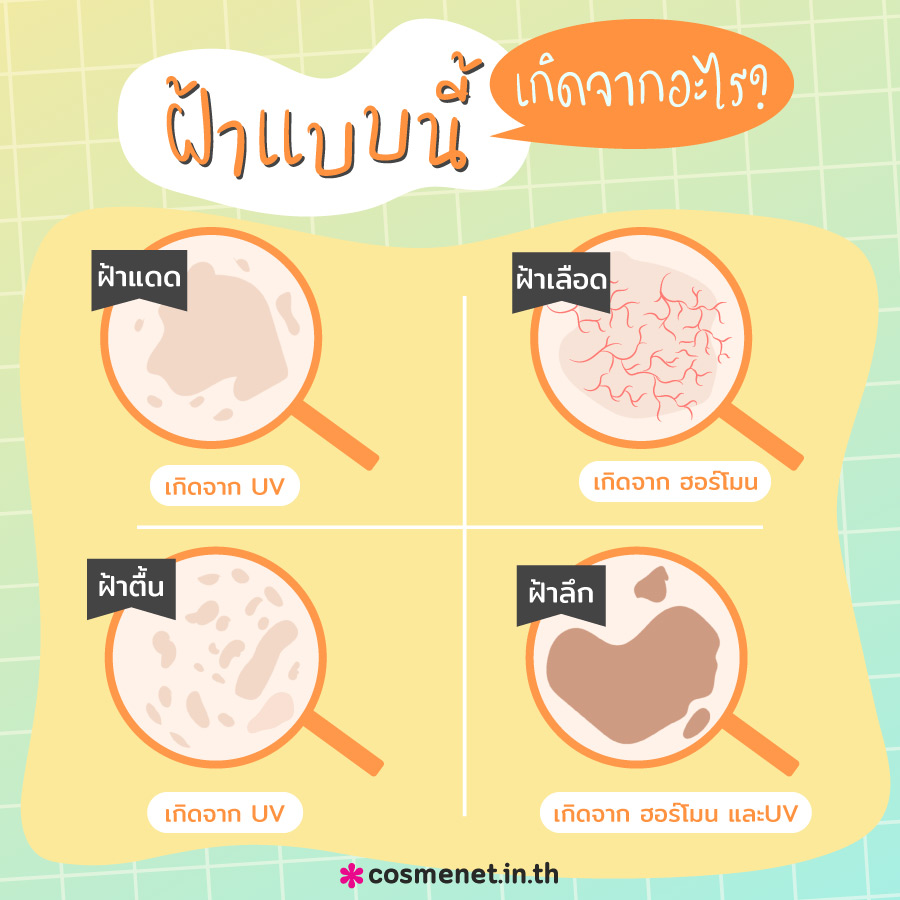 ประเภทของฝ้า