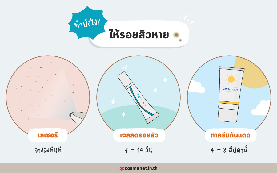 เจลลดรอยสิว รีวิว