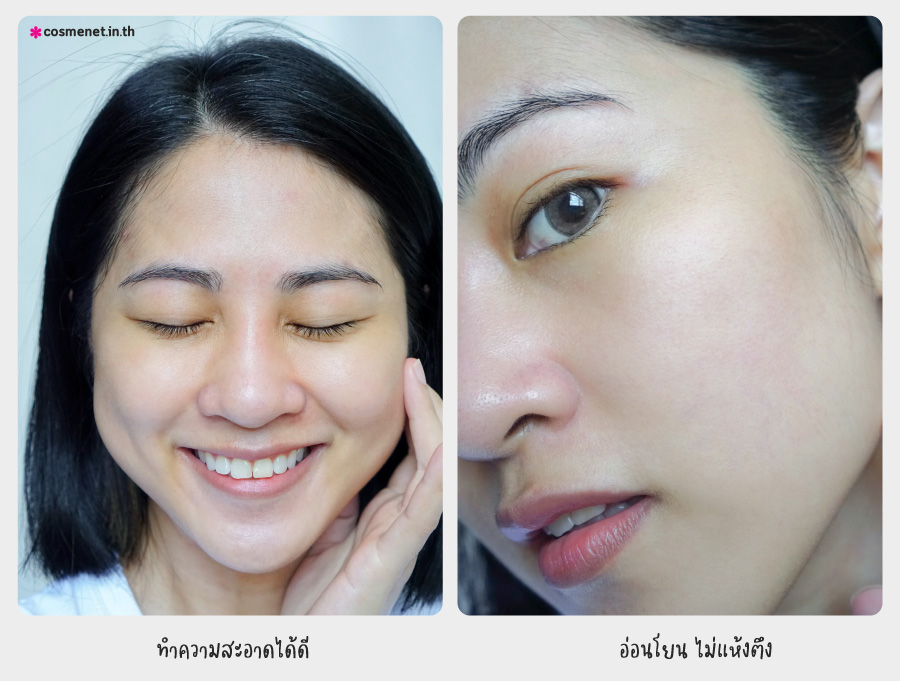 รีวิว MizuMi Gentle Acne Wash