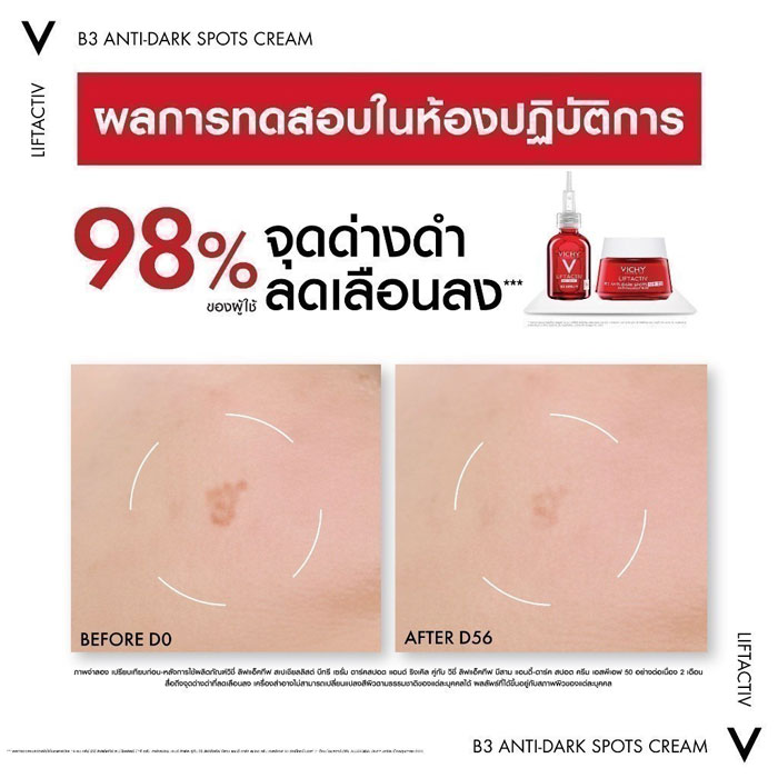 เดย์ครีม Vichy Liftactiv B3 Anti-Dark Spots Cream SPF 50